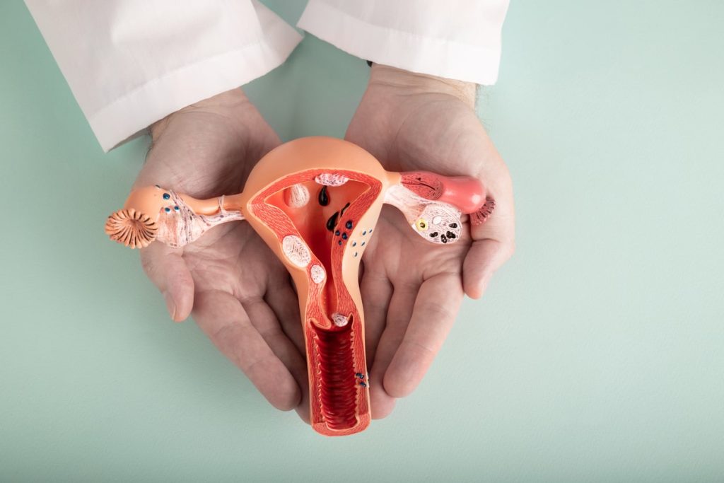 iCareBetter Find the best endometriosis specialists