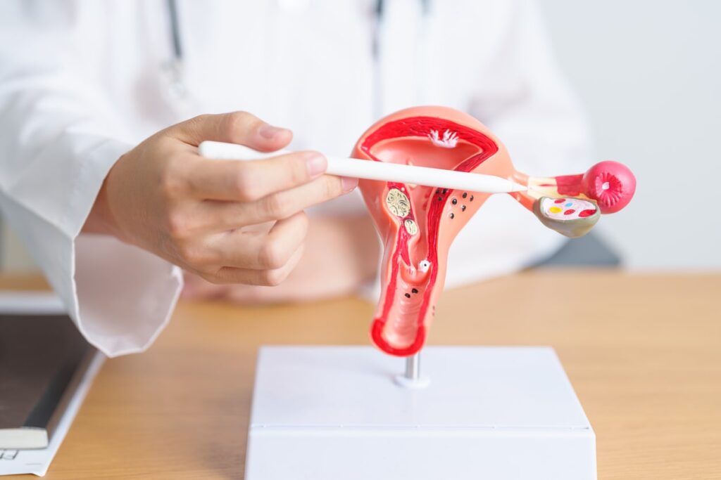 What is endometriosis